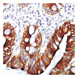 Epredia Lab Vision Cytokeratin 20 Ab-1, Mouse Monoclonal Antibody:Antibodies:Primary