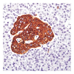 Epredia Lab Vision Synaptophysin (Neuroendocrine Marker) Rabbit Monoclonal
