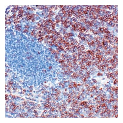 Epredia Lab Vision CD10/CALLA (Neutral Endopeptidase) Ab-2, Mouse Monoclonal