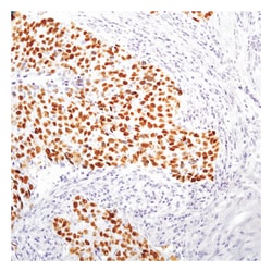 Epredia Lab Vision p53 Rabbit Monoclonal Antibody (Clone SP5):Antibodies:Primary