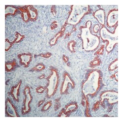 Epredia Lab Vision Cytokeratin 20 Ab-1, Mouse Monoclonal Antibody 7mL;