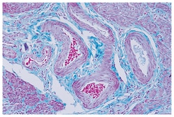 Epredia&trade;&nbsp;Richard-Allan Scientific&trade; Gomori Trichrome (Green Collagen), Gomori Trichrome Stain Solution, Green Collagen