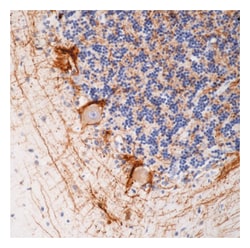 Epredia Lab Vision Neurofilament (200kDa 68kDa) Ab-1, Mouse Monoclonal