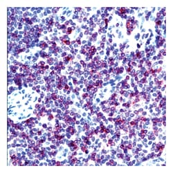 CD3 (Early T-Cell Marker) Ab-1 Rabbit Polyclonal Antibody, Epredia 100&mu;L;