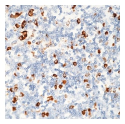 Epredia Lab Vision Plasma Cell Ab-1 Mouse Monoclonal Antibody, 50 g/mL,