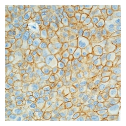 Epredia Lab Vision Epithelial Specific Antigen/Ep-CAM Ab-2 Mouse Monoclonal