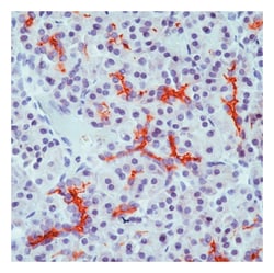 Epredia Lab Vision Cystic Fibrosis Transmembrane Regulator (CFTR) Ab-4
