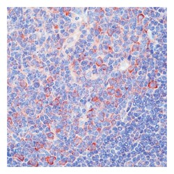 Epredia Lab Vision HDJ-2/DNAJ Ab-1 Mouse Monoclonal Antibody, 200 g/mL,