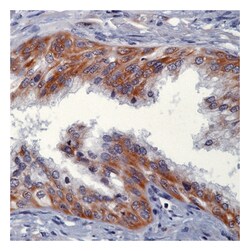 Epredia Lab Vision Heregulin/NDF/GGF/Neuregulin Ab-1 Mouse Monoclonal Antibody,