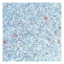 Epredia Lab Vision CD25/IL-2R Ab-4, Mouse Monoclonal Antibody:Antibodies:Primary