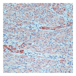 Epredia Lab Vision Myosin, Smooth Muscle Heavy Chain, Ab-1 Mouse Monoclonal