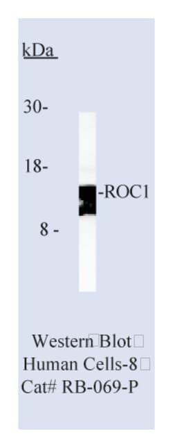 ROC1 Ab-1 Rabbit Polyclonal Antibody, Epredia:Antibodies:Primary Antibodies