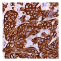 Epredia Lab Vision Cytokeratin 8 Rabbit Monoclonal Antibody:Antibodies:Primary