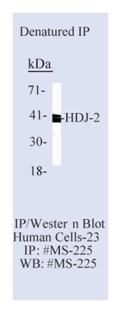 Epredia Lab Vision HDJ-2/DNAJ Ab-1 Mouse Monoclonal Antibody, 200 g/mL,