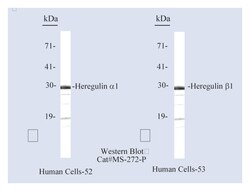 Epredia Lab Vision Heregulin/NDF/GGF/Neuregulin Ab-1 Mouse Monoclonal Antibody,