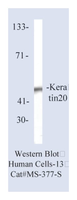 Epredia Lab Vision Cytokeratin 20 Ab-1, Mouse Monoclonal Antibody:Antibodies:Primary
