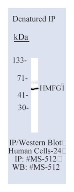 Epredia Lab Vision Milk Fat Globule 1 Human (HMFG1) Ab-1 Mouse Monoclonal