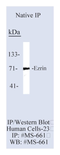 Epredia Lab Vision Ezrin/p81/80K/Cytovillin Ab-1 Mouse Monoclonal Antibody,