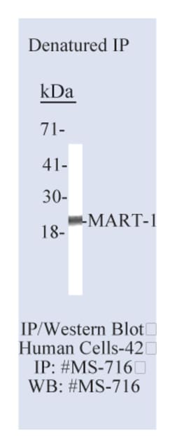 MART-1/Melan-A (Melanoma Marker) (Cocktail) Ab-3 Mouse Monoclonal Antibody,