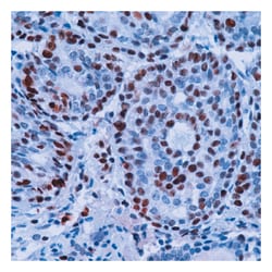 Epredia Lab Vision PCNA (Proliferating Cell Nuclear Antigen) Ab-1 Mouse