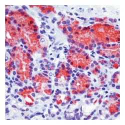 Survivin Ab-6, Rabbit Polyclonal Antibody,Lab Vision Epredia:Antibodies:Primary