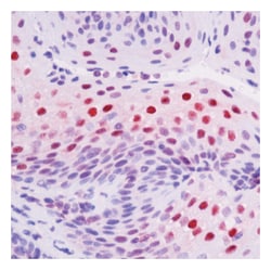 Epredia Lab Vision Raf-1 (Phospho-specific) Ab-2 Rat Monoclonal Antibody