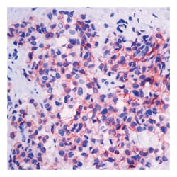 Epredia Lab Vision Cadherin E Ab-4, Mouse Monoclonal Antibody:Antibodies:Primary