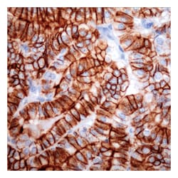 Thyroid Cancer Marker, Mouse Monoclonal Antibody,Lab Vision Epredia:Antibodies:Primary