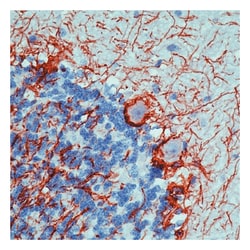 Epredia Lab Vision Neurofilament (200kDa 68kDa) Ab-1, Mouse Monoclonal