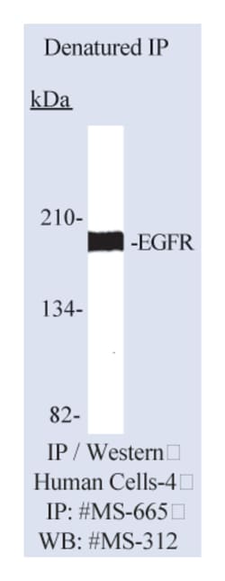 Epidermal Growth Factor Receptor/EGFR Ab-15 Mouse Monoclonal Antibody,