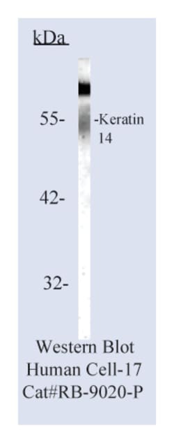 Cytokeratin 14 Rabbit Polyclonal Antibody, Epredia:Antibodies:Primary Antibodies