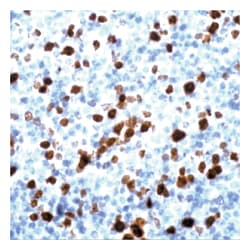 Ki-67 Rabbit Polyclonal Antibody, Epredia 7mL; Unlabeled; Ready-to-use