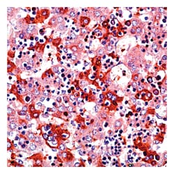 Epredia Lab Vision -Fetoprotein (AFP), Rabbit Polyclonal Antibody:Antikörper:Primärantikörper