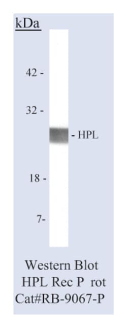 Placental Lactogen (hPL) Rabbit Polyclonal Antibody, Epredia:Antibodies:Primary
