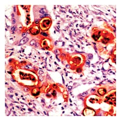 Epredia Lab Vision CA19-9/Sialyl Lewisa (GI Tumor Marker) Mouse Monoclonal