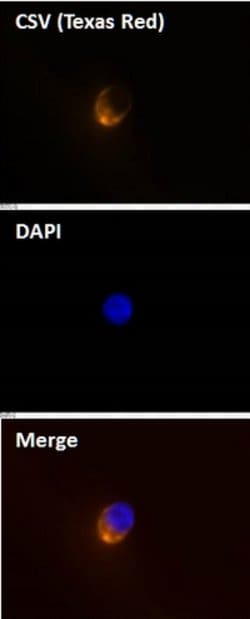 Cell-Surface Vimentin (CSV) Mouse anti-Human, Texas Red, Clone:84-1, Abnova 50 &mu;g | Buy Online | Abnova | Fisher Scientific