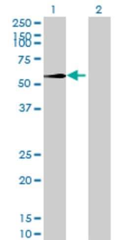 RNMTL1 Mouse anti-Human, Polyclonal, Abnova 50&mu;g:Antibodies, Polyclonal