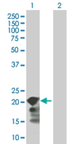 SELS Mouse anti-Human, Polyclonal, Abnova 50&mu;g:Antibodies, Polyclonal