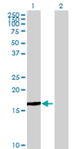 PHC3 Mouse anti-Human, Polyclonal, Abnova 50&mu;g:Antibodies, Polyclonal