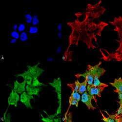 Abcc8 Mouse anti-Human, Rat, FITC, Clone:S289-16, Abnova 100&mu;g:Antibodies,