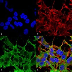 Abcc9 Mouse anti-Human, Mouse, Rat, Biotin, Clone:S319A-14, Abnova 100&mu;g:Antibodies,