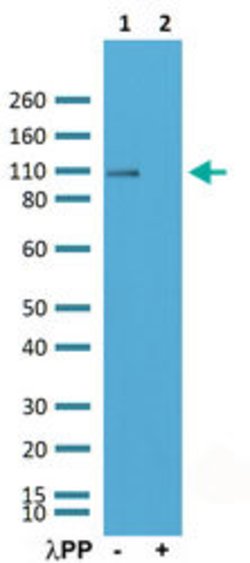 GRIA1 (phospho S845) Rabbit anti-Human, Mouse, Rat, Clone:RM296, Abnova
