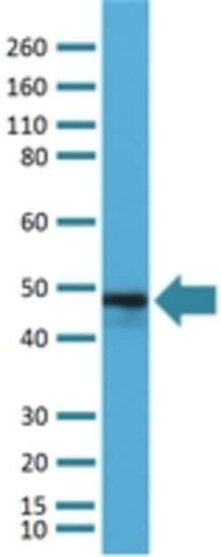 CD79A Rabbit anti-Human, Clone:RM297, Abnova 100&mu;L:Antibodies, Monoclonal