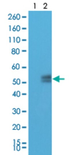 PDCD1 Rabbit anti-Human, Clone:RM309, Abnova 100&mu;L:Antibodies, Monoclonal