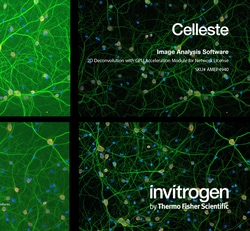 Invitrogen™ Celleste™ 2D Deconvolution with GPU Acceleration Module, network license