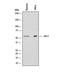 Human RIPK2/RIP2 Antibody, R D Systems:Antibodies:Primary Antibodies