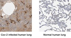 SARS-CoV-2 Nucleocapsid Antibody, R D Systems 25 &mu;g | Buy Online | R&D Systems | Fisher Scientific