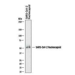SARS-CoV-2 Nucleocapsid Antibody, R D Systems 25 &mu;g | Buy Online | R&D Systems | Fisher Scientific