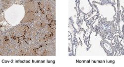 SARS-CoV-2 Nucleocapsid MAb (Clone 1035111), R D Systems 25 &mu;g; Unconjugated:Antibodies,