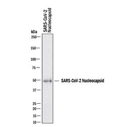 SARS-CoV-2 Nucleocapsid MAb (Clone 1035111), R D Systems 25 &mu;g; Unconjugated:Antibodies,